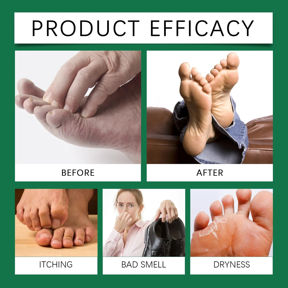 Foot Softening Spray – Exfoliator for Calluses & Rough Skin