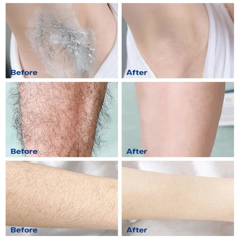 3-Minute Hair Removal Cream – Face, Lip, Arms & Legs