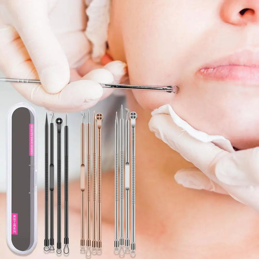 4-Piece Blackhead Remover Tool Set – Stainless Steel Acne Kit