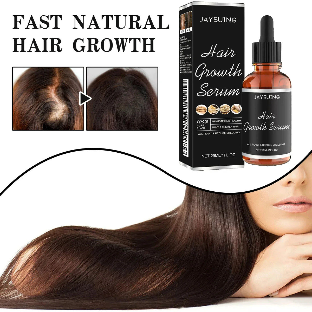 Jaysuing Hair Loss Essence – Scalp Nourishing Regrowth Serum