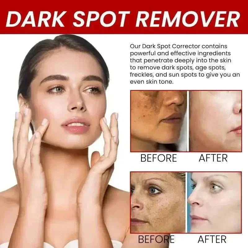 Niacinamide Dark Spot Brightening Cream – Even Skin Tone 30ml