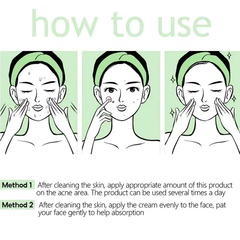 Herbal Acne Face Cream – Pore Minimizing & Skin Brightening Gel