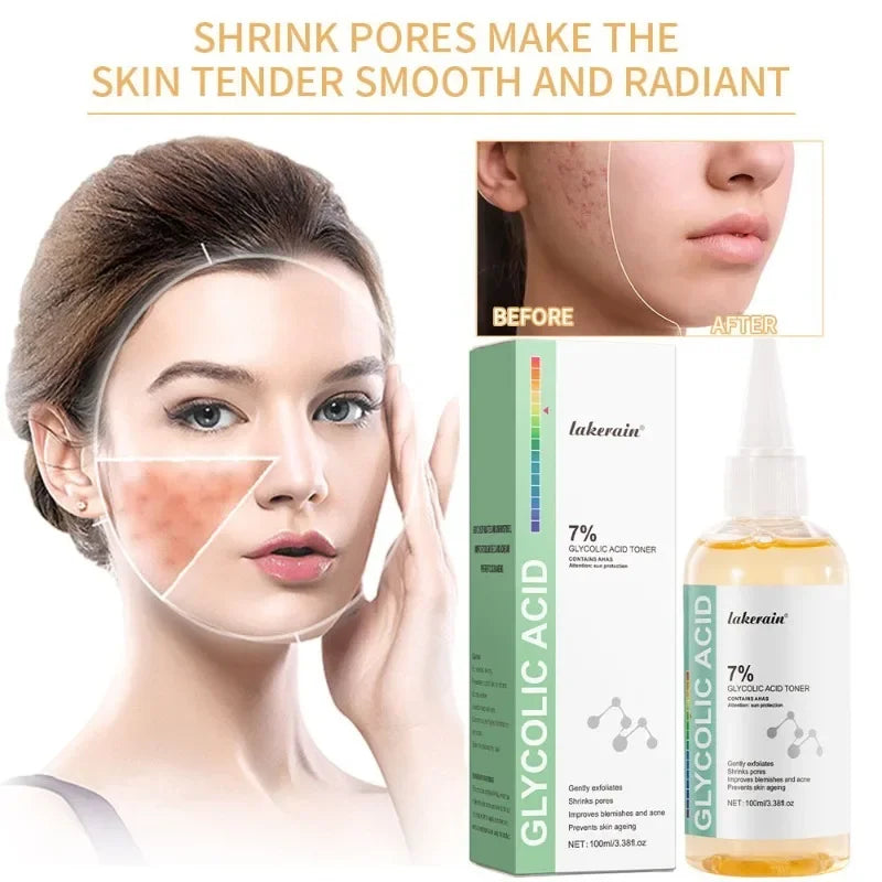 Glycolic Acid 7 Toning Solution Ordinary Acne Remover Lifting Firming
