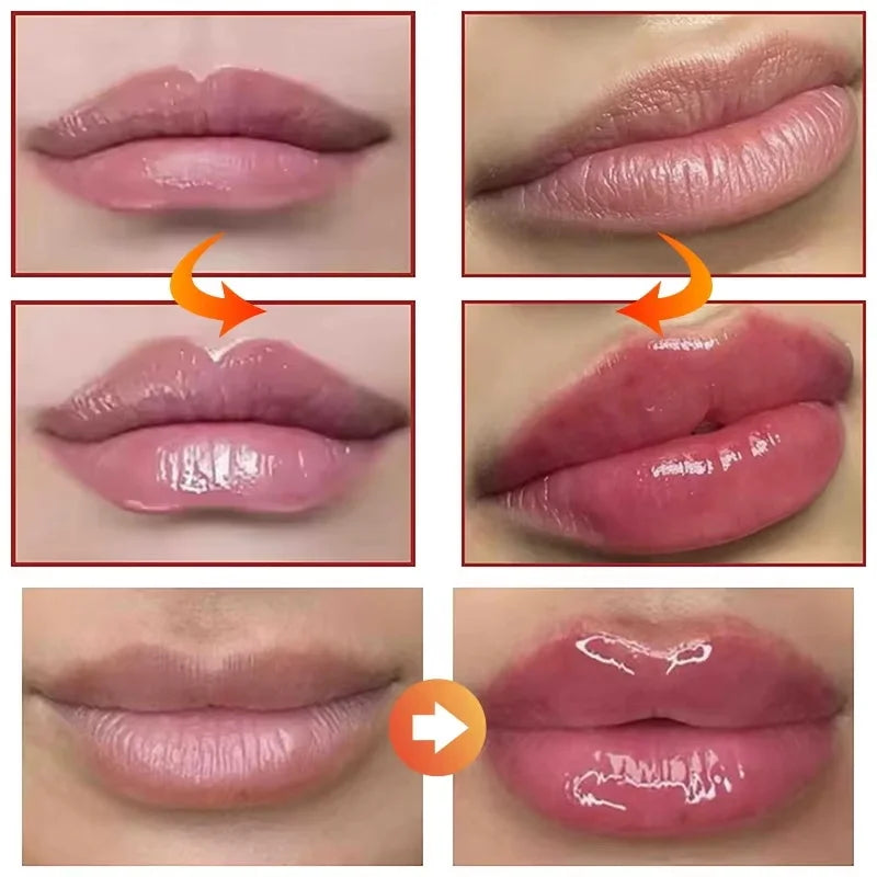 Eelhoe Plumping Lip Balm – Moisturizing & Anti-Aging Lip Oil