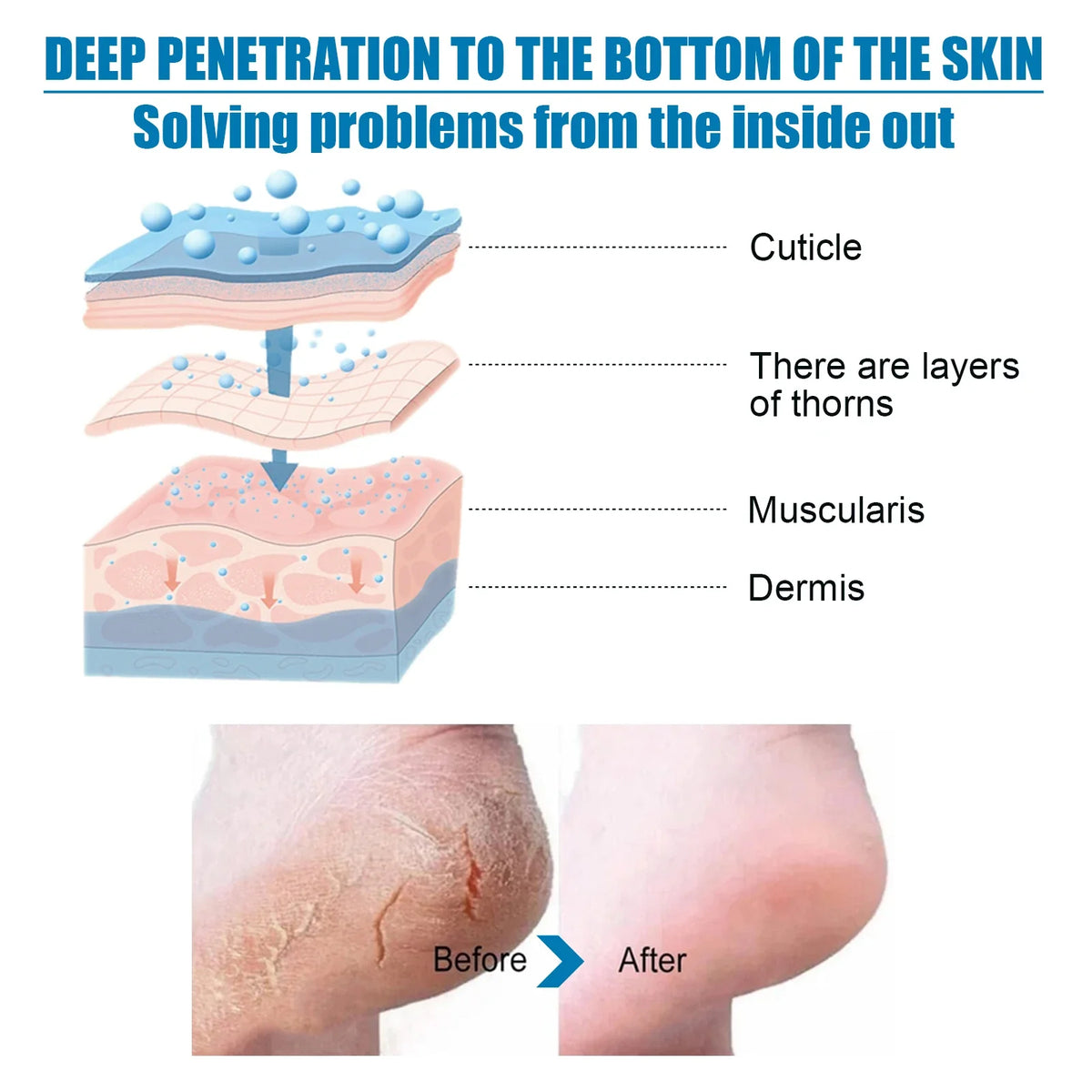 Exfoliating Foot Peel Mask | Remove Calluses & Dead Skin