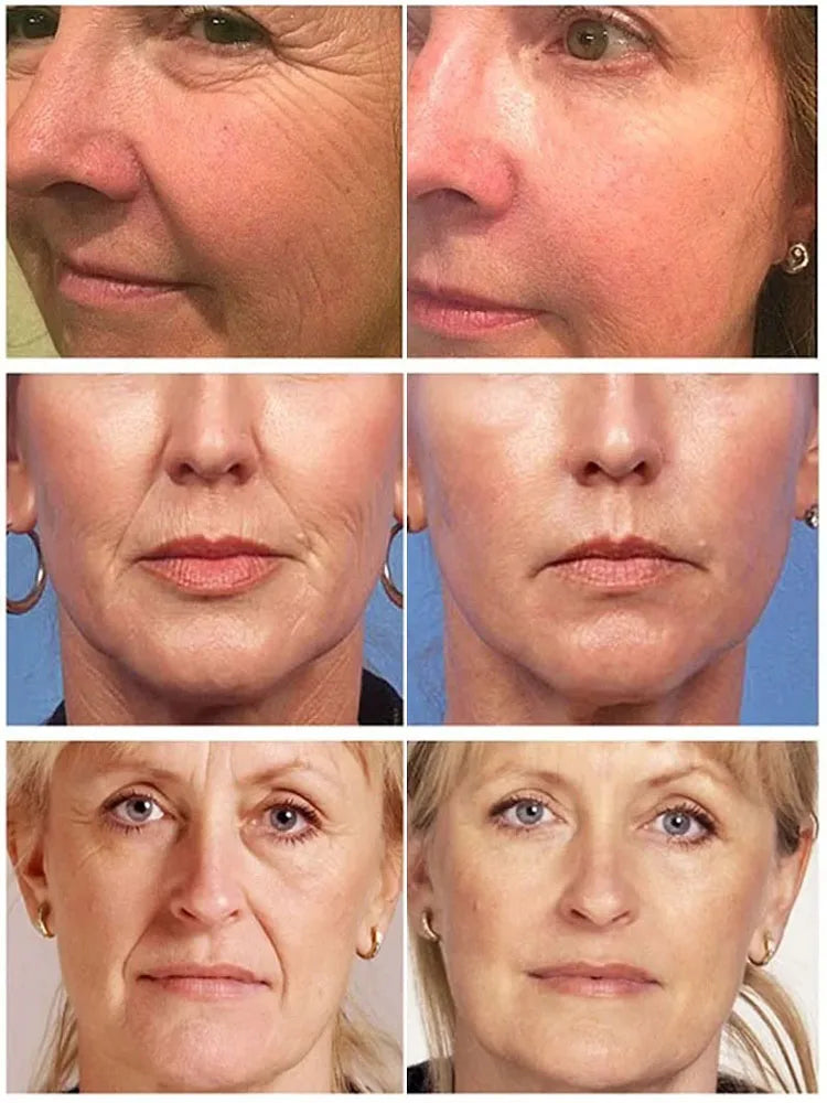 Collagen Face Serum & Cream Set – Firming & Brightening