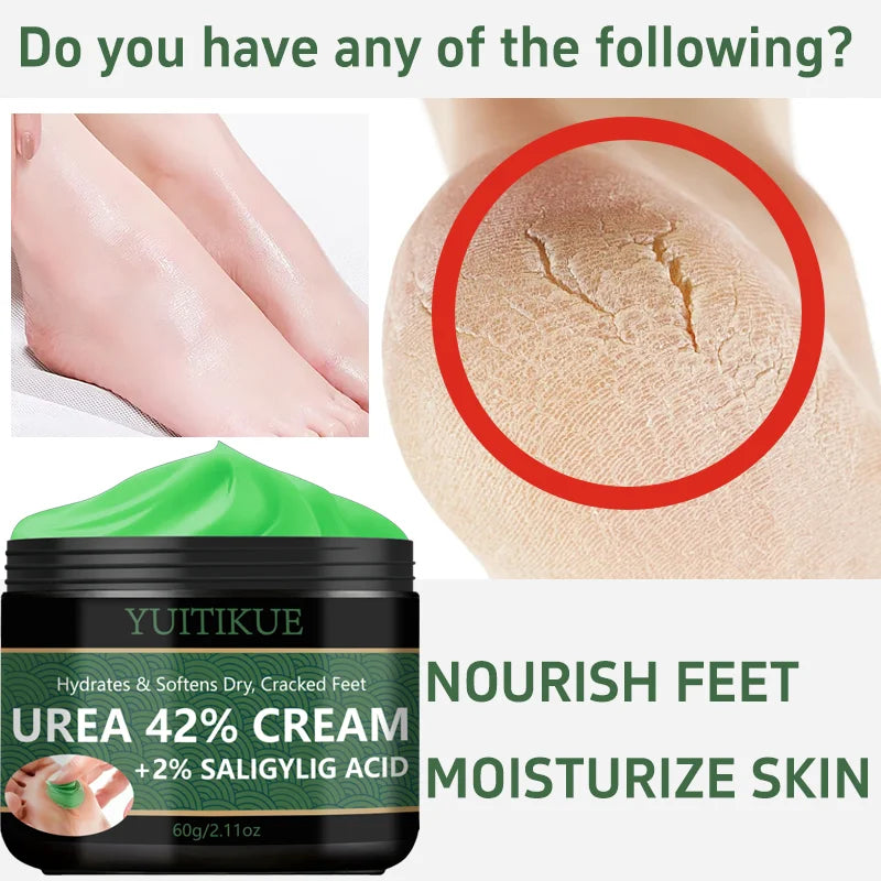 YUITIKUE 42% Urea Foot Cream – Softens Calluses & Hydrates