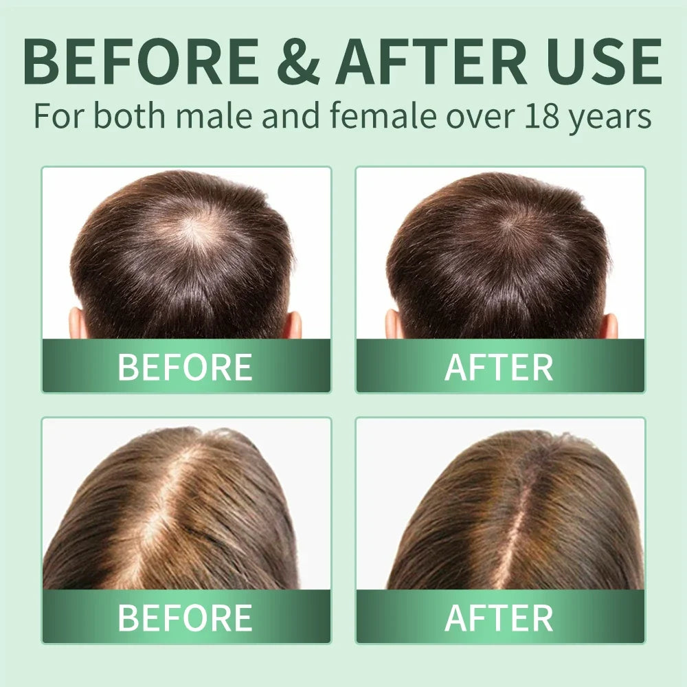 Rosemary Scalp Scrub Shampoo & Hair Growth Serum Spray