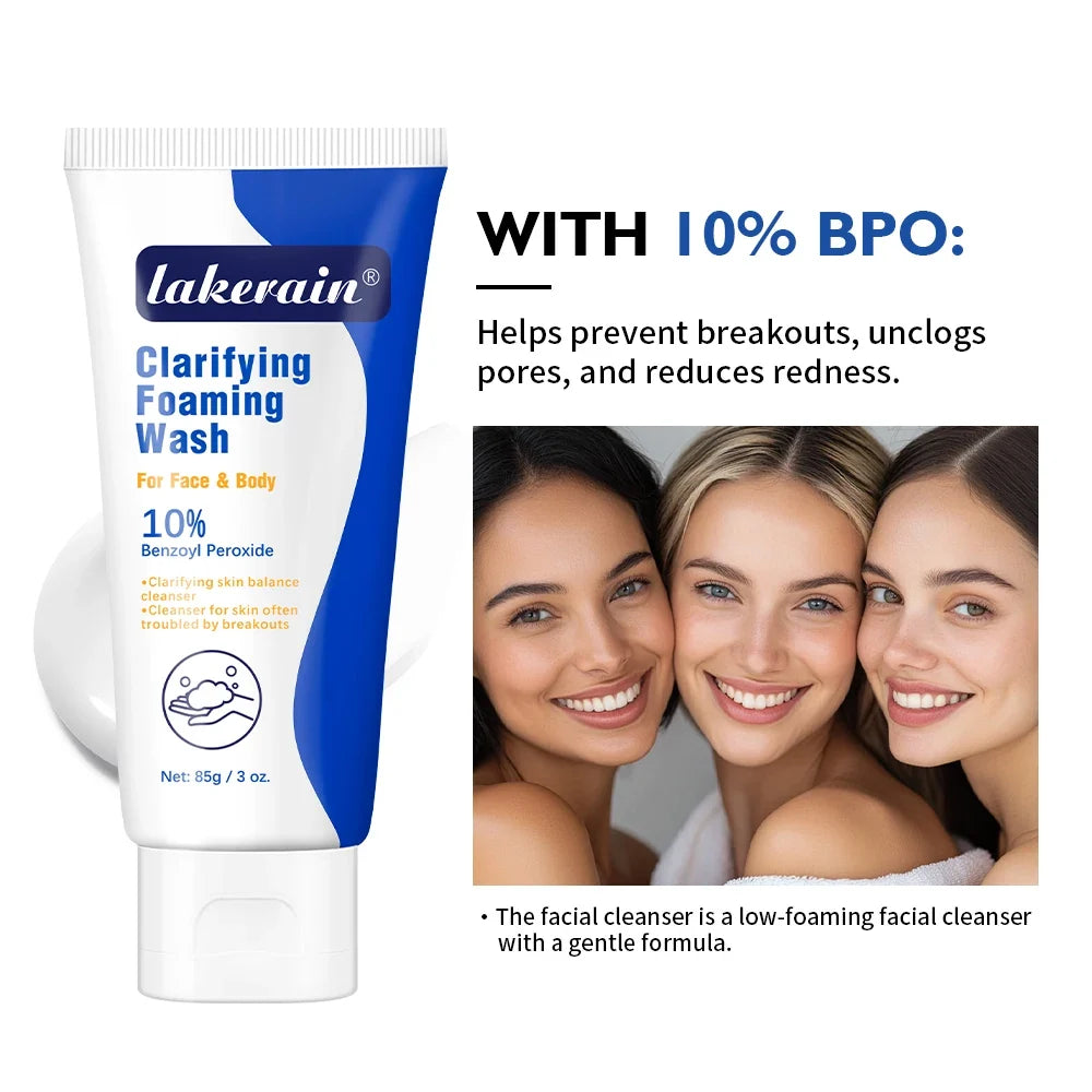10% Benzoyl Peroxide Foaming Wash – Face & Body Cleanser