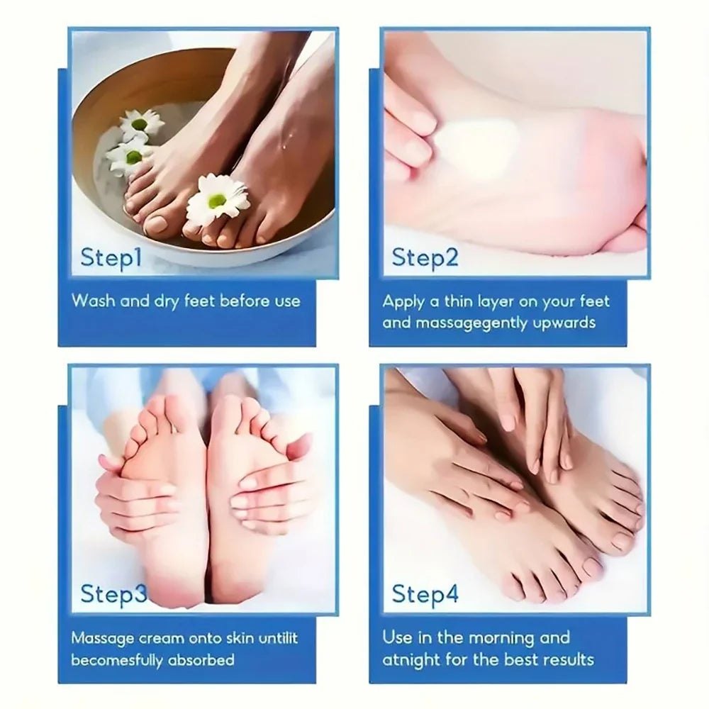 SUYARUN 60% Urea Foot Cream – Callus Remover & Heel Moisturizer