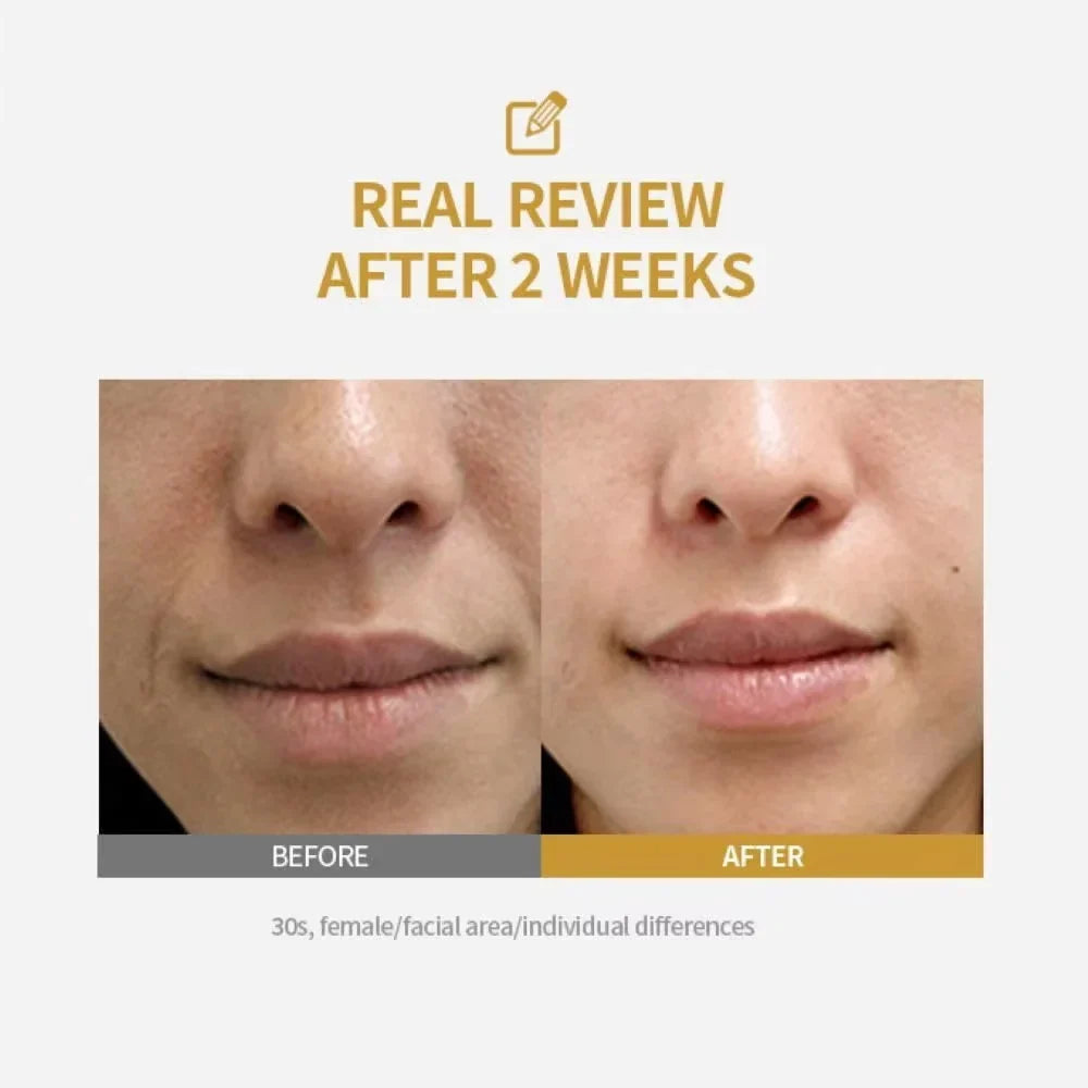 Peptide Lifting Ampoule Collagen Face Firming Serum K-Beauty