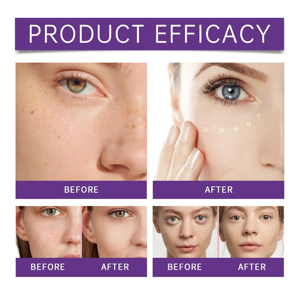 Eelhope Moisturizing Concealer – Lightweight & Long-Lasting