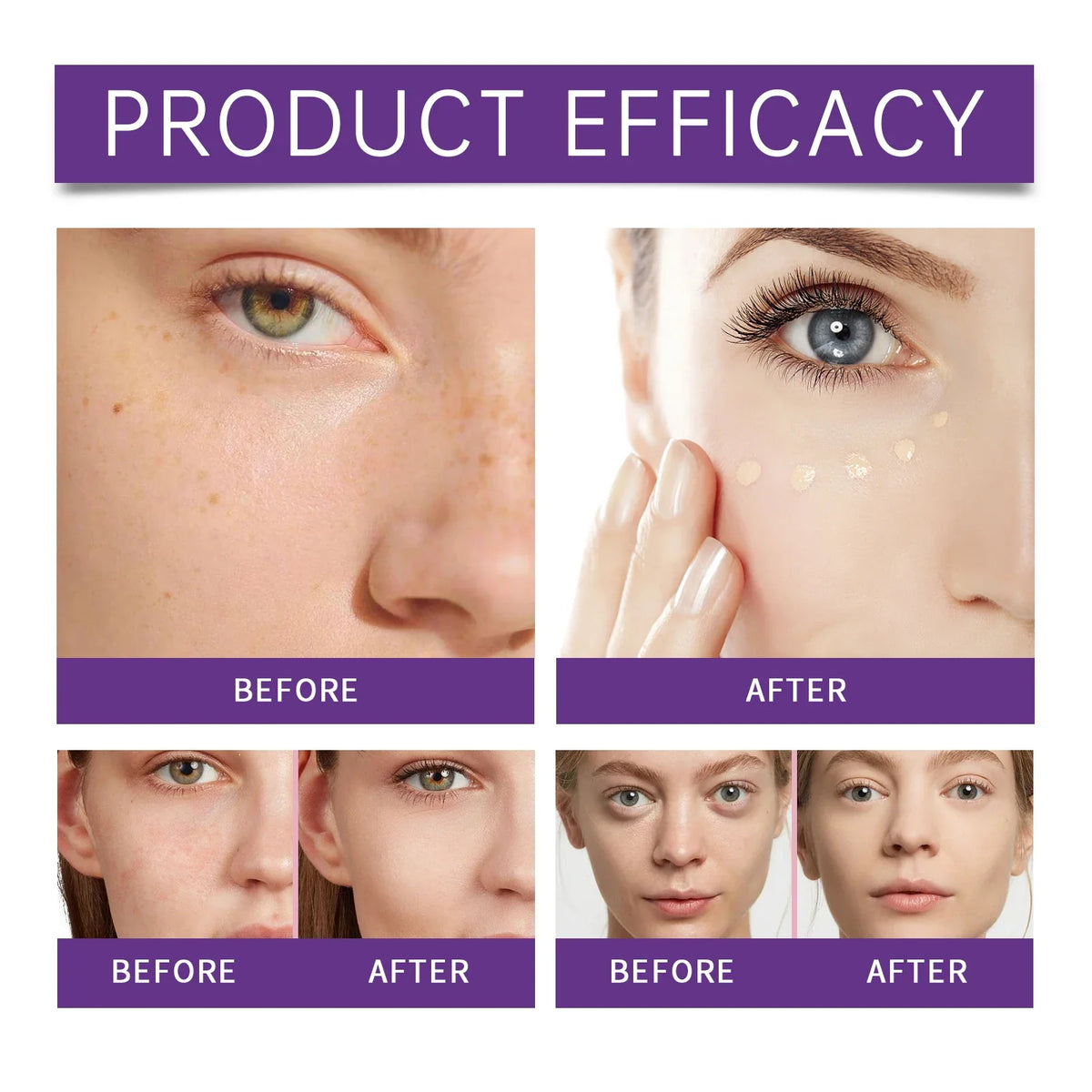 Eelhope Moisturizing Concealer – Lightweight & Long-Lasting
