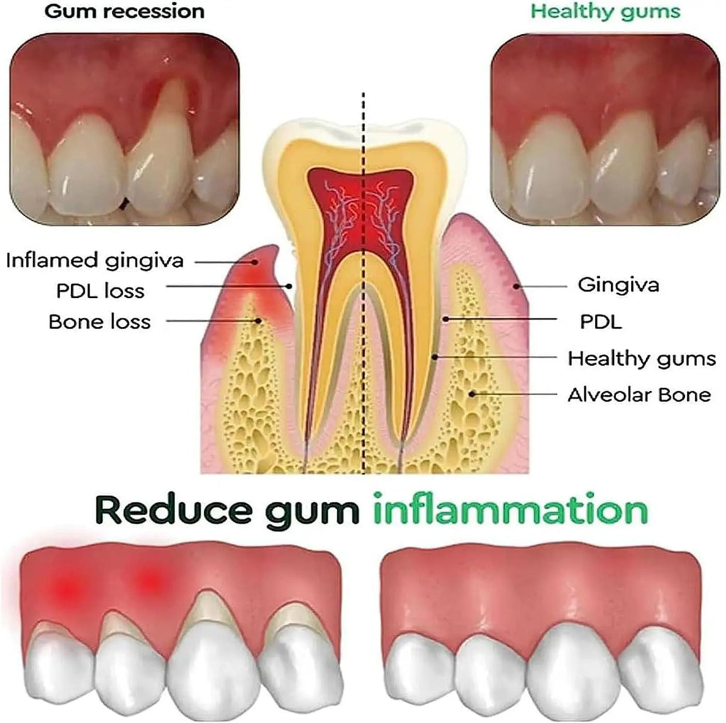 Eelhoe Gum & Tooth Repair Serum | Natural Plant Formula 30ml