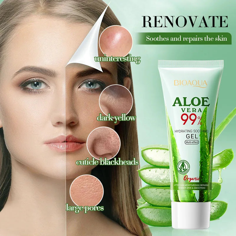 SADOER Aloe Vera Gel – Hydrating Moisturizer for Face & Body