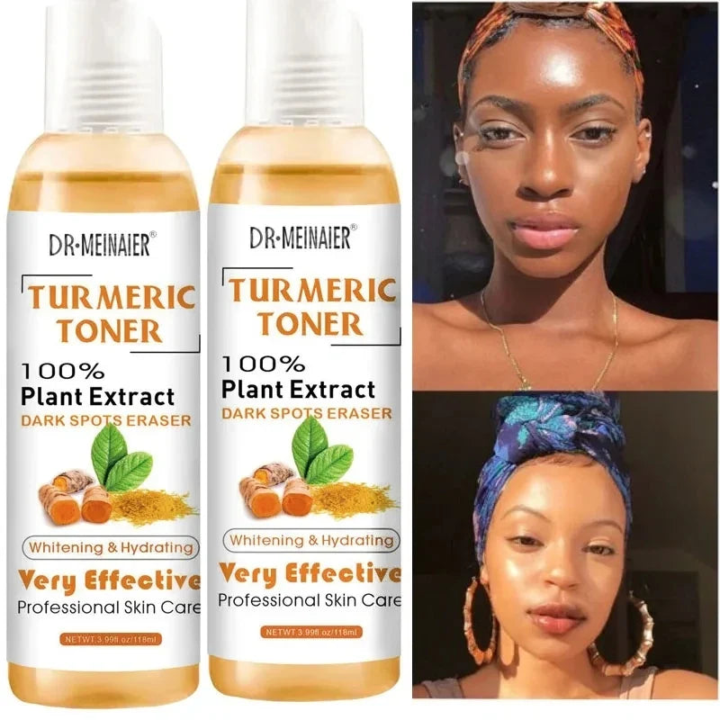 Tumeric Dark Spots Toner Eraser Corrector Turmeric Fade Blemishes