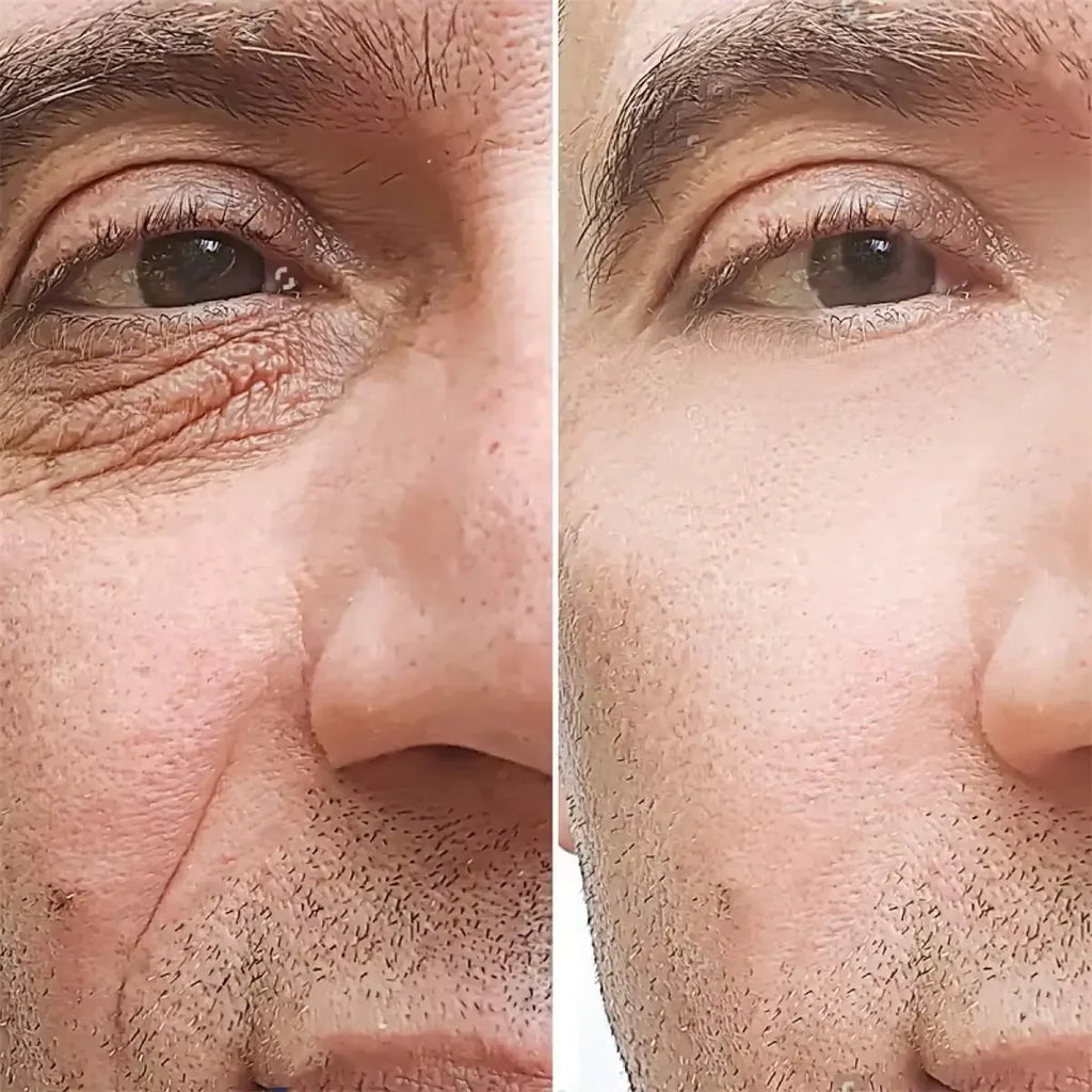 Retinol Eye Cream for Men – Firming & Brightening | 15g