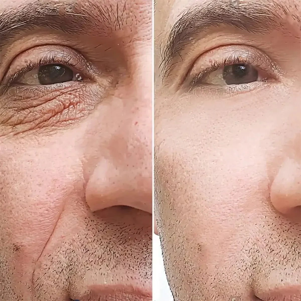 Retinol Eye Cream for Men – Firming & Brightening | 15g