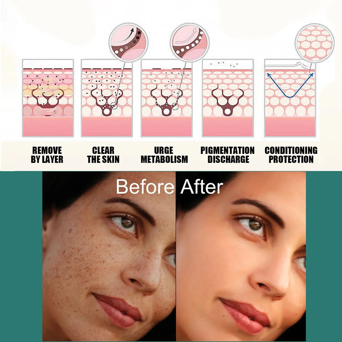 Eelhoe Vitamin C Face Cream – Dark Spot & Brightening Corrector