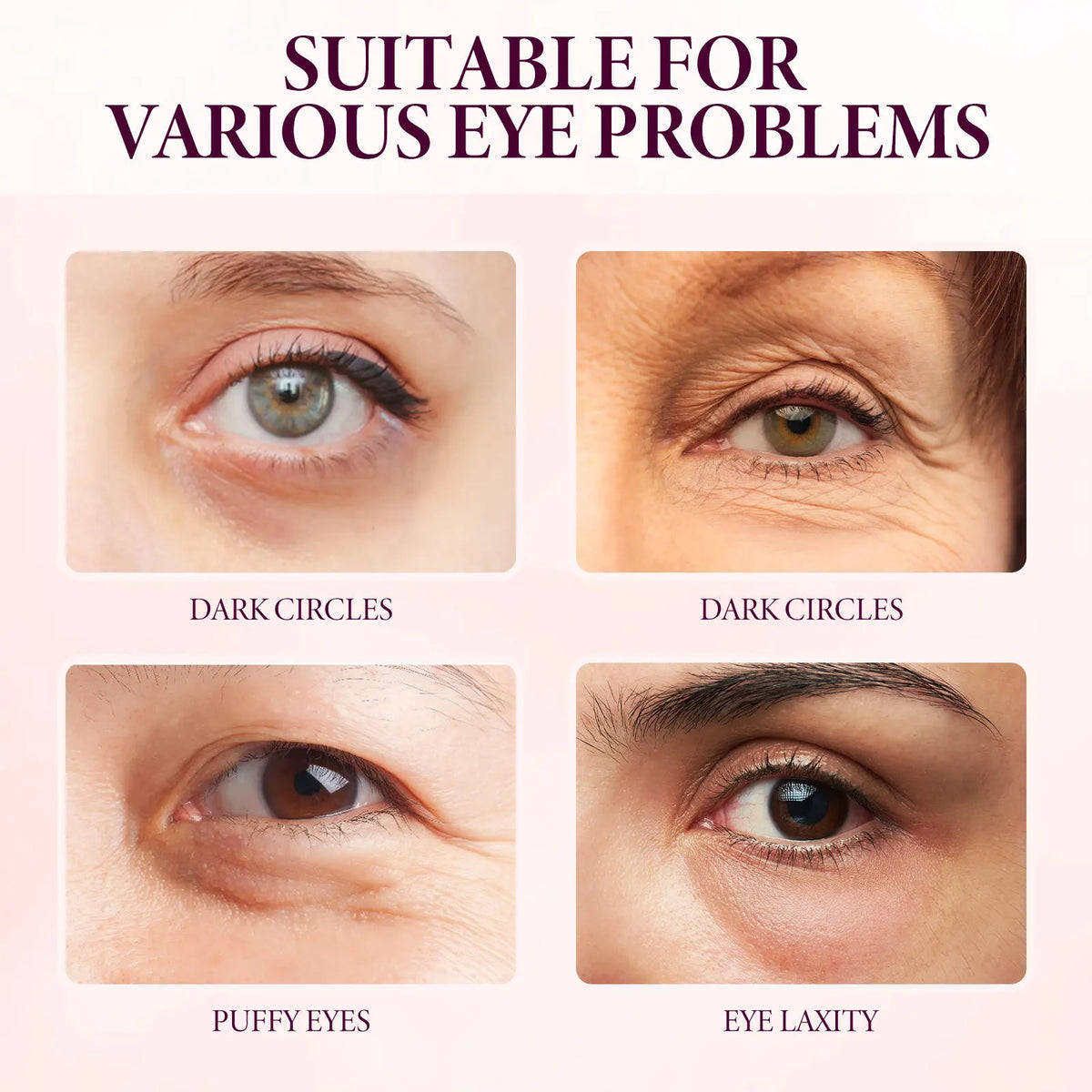 EELHOE Mango Eye Cream – Firming, Dark Circle & Fine Line Reducer