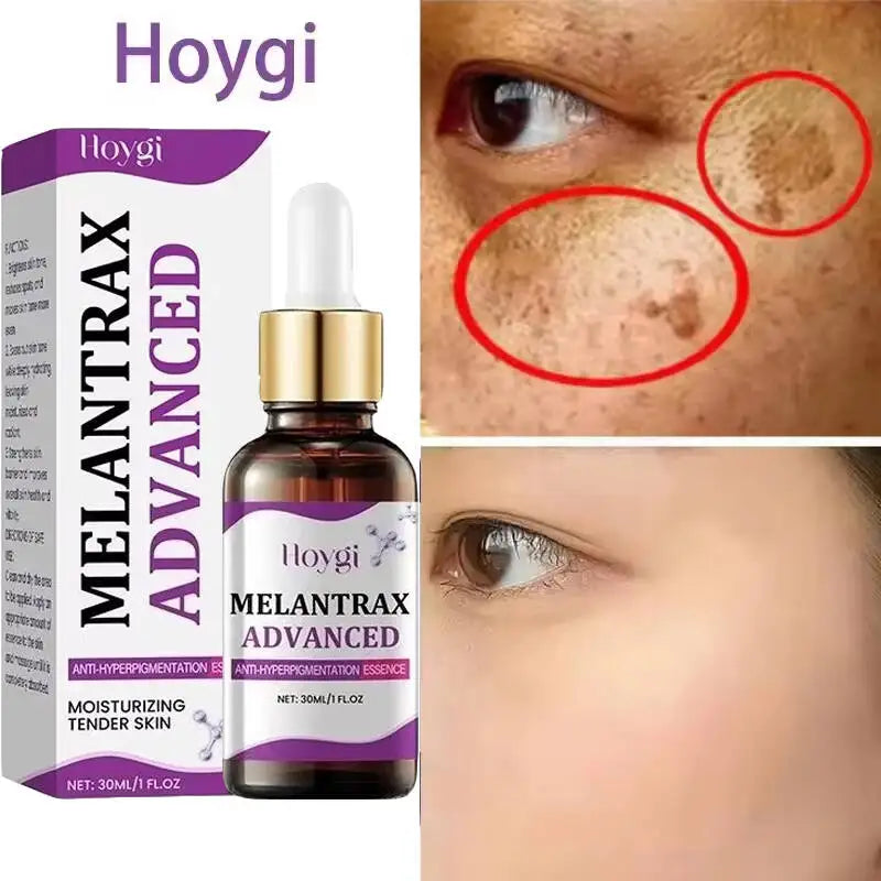 Hoygi Niacinamide Vitamin B3 Face Serum – Glow & Dark Spot Corrector