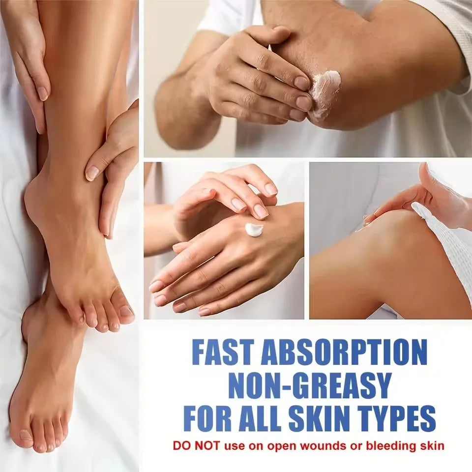 40 Urea Cream Feet 2 Salicylic Acid Foot Hand Cracked Heels&dry Skin