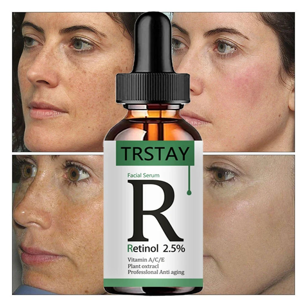 Retinol 2 5 Vitamin C Facial Anti Wrinkle Serum Remove Dark Spots