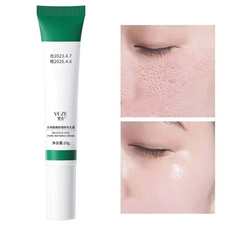 Salicylic Acid Pore Refining Cream – Blackhead & Oil Control