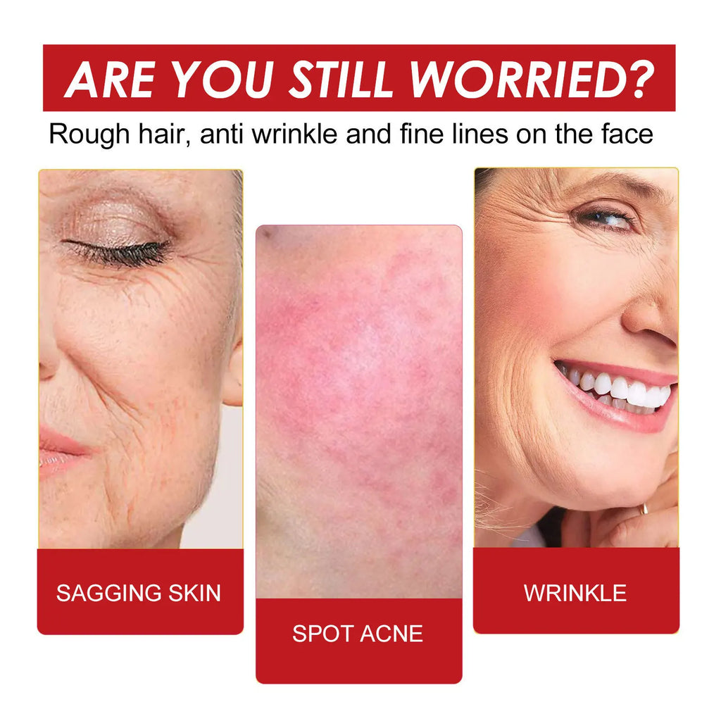 EELHOE 30ml Organic Rosehip Oil Face Serum – Hydrating & Firming