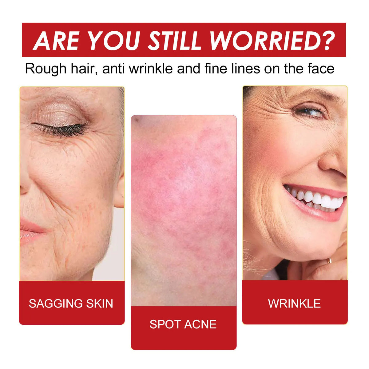 EELHOE 30ml Organic Rosehip Oil Face Serum – Hydrating & Firming