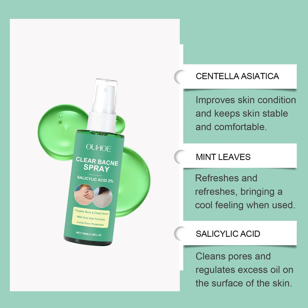 Back Acne Treatment Spray – Oil Control & Soothing Body Spray
