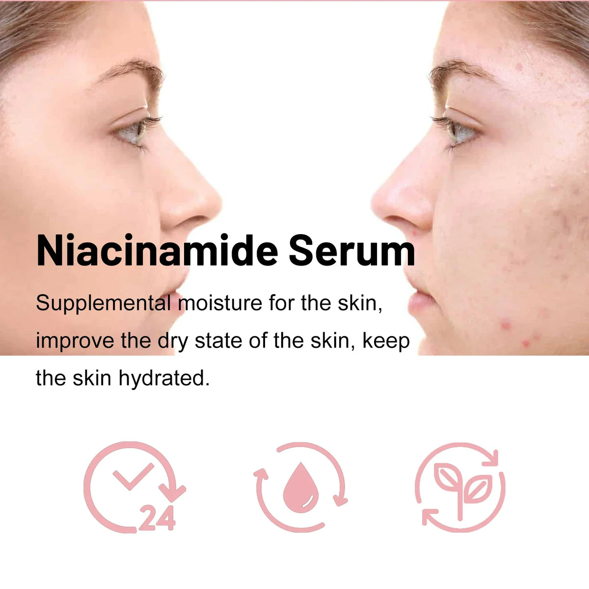 Ouhoe Nicotinamide Brightening Face Serum 30ml – Anti-Aging