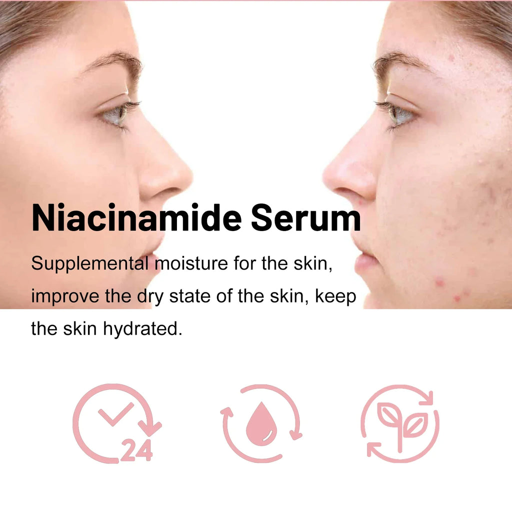 Ouhoe Nicotinamide Brightening Face Serum 30ml | Firming Essence