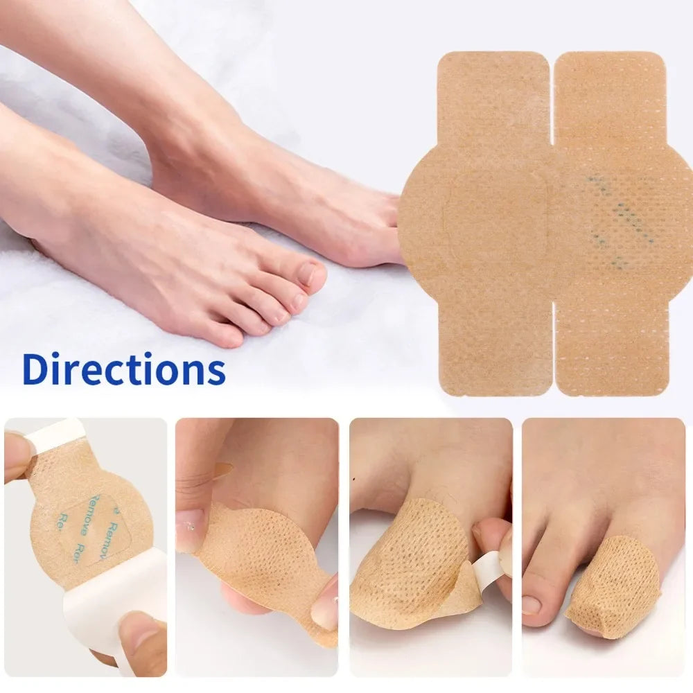 Nail Repair Patches – Ingrown Toenail & Nail Care Stickers