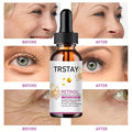 Face Serum Oil Essential Anti Aging Hyaluronic Acid Anti-wrinkles
