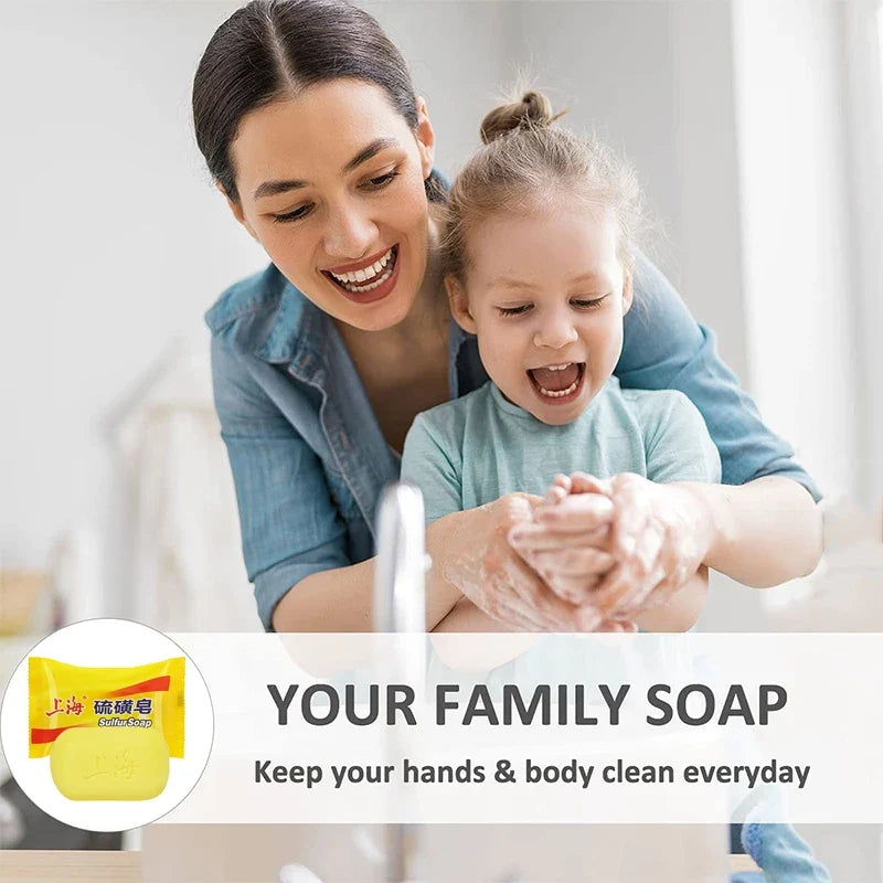 Shanghai Sulfur Soap – Oil Control & Acne Cleanser 3/5 Pack