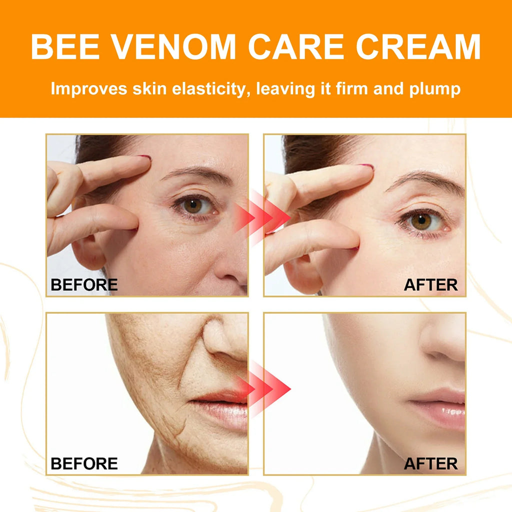 YURHERSU Bee Venom Facial Cream – Lifting & Firming 50g