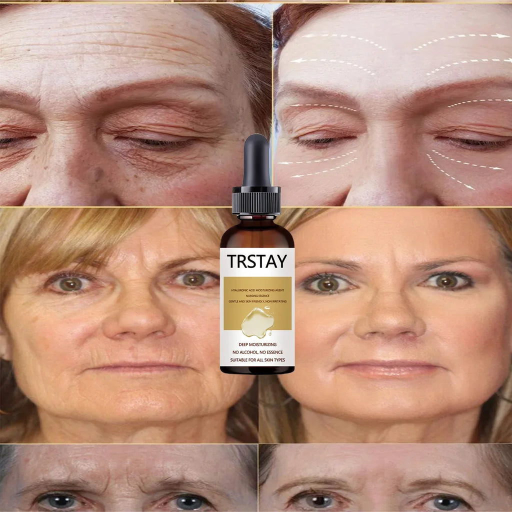 Snail Extract Serum Face Essence Anti Wrinkle Hyaluronic Acid Aging