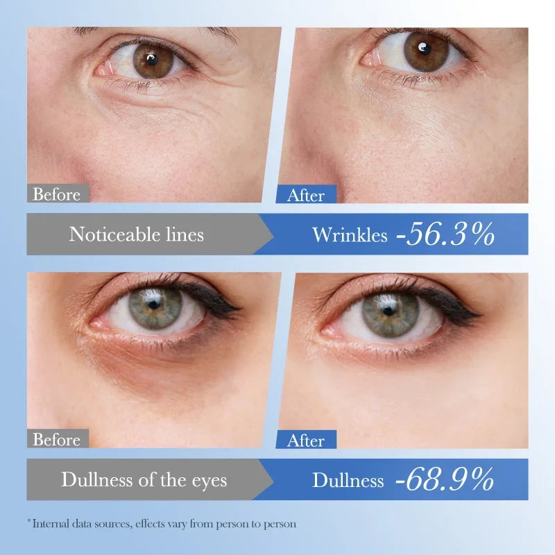 Caviar & Hyaluronic Acid Eye Cream – Firming & Brightening 20g