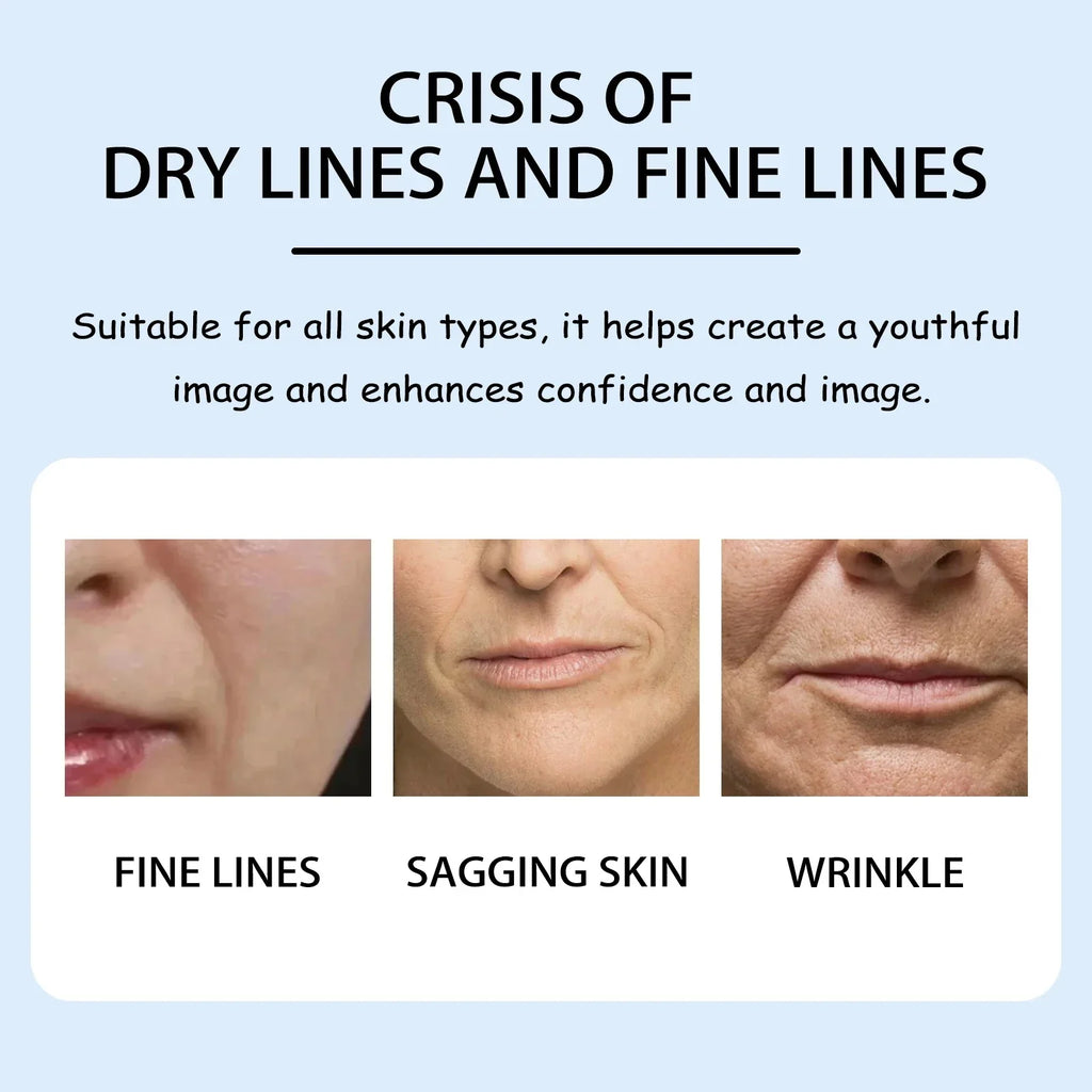 Collagen & Retinol Overnight Wrinkle Patches – Firm & Lift