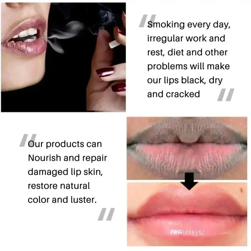 SADOER Lip Lightening Balm – Exfoliating & Brightening