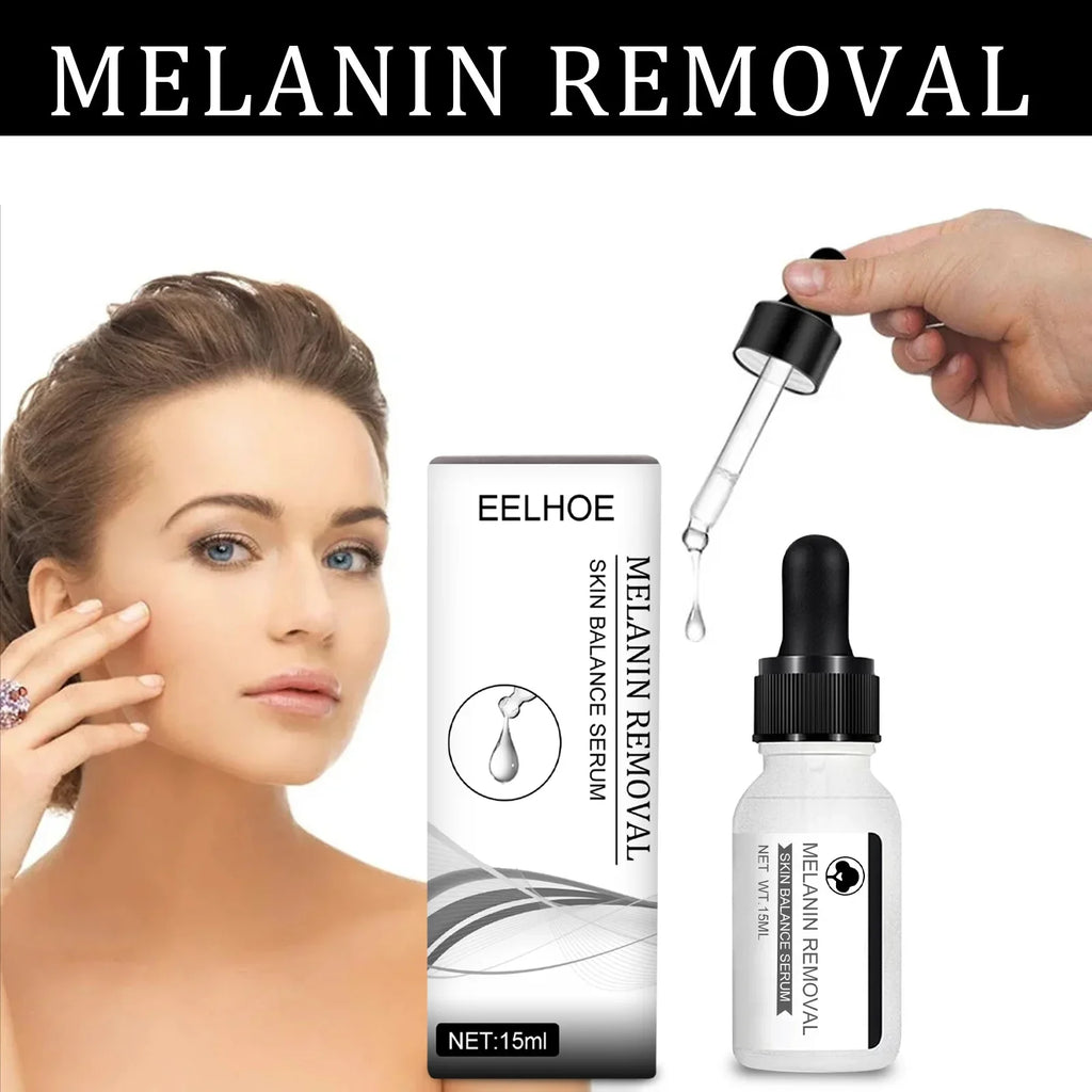 Niacinamide Dark Spot Serum – Fade Melasma & Brighten Skin