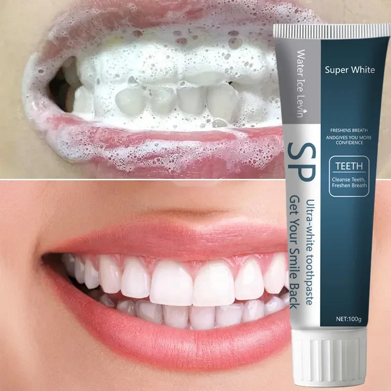 SP Probiotic Whitening Toothpaste – Fresh Breath & Gum Care