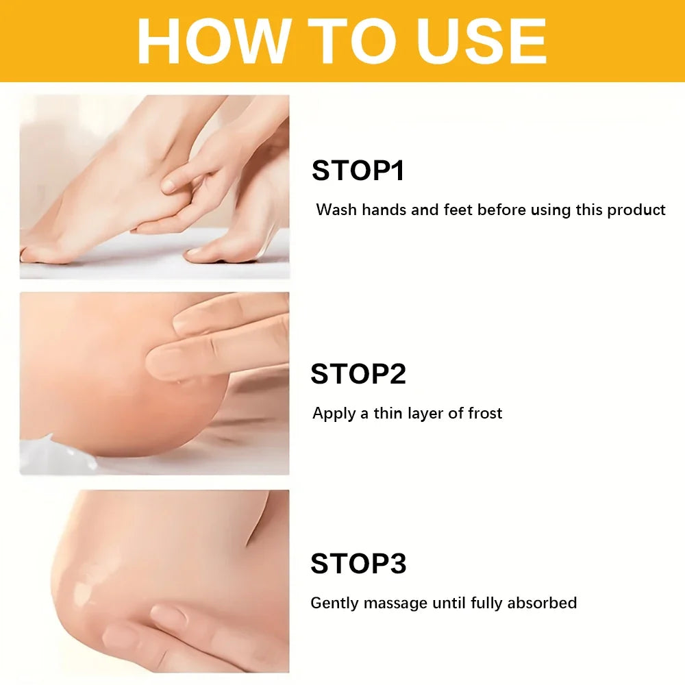 SUYARUN 60% Urea Foot Cream – Callus & Dead Skin Remover