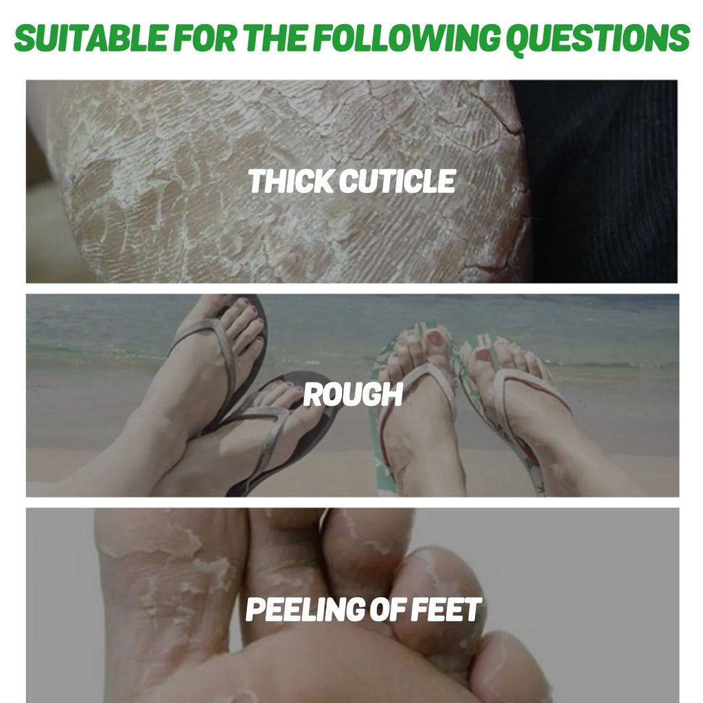 Aloe Vera Moisturizing Foot Mask Booties 5 Pairs | Hydrating