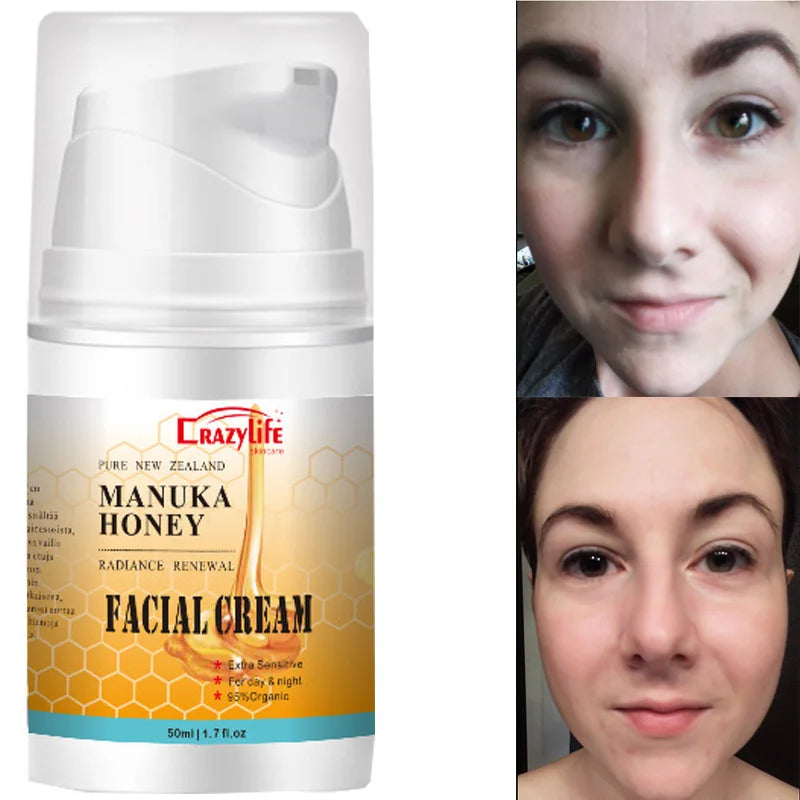 Newzealand Bee Venom Honey Facial Cream Firming Lifting Skin