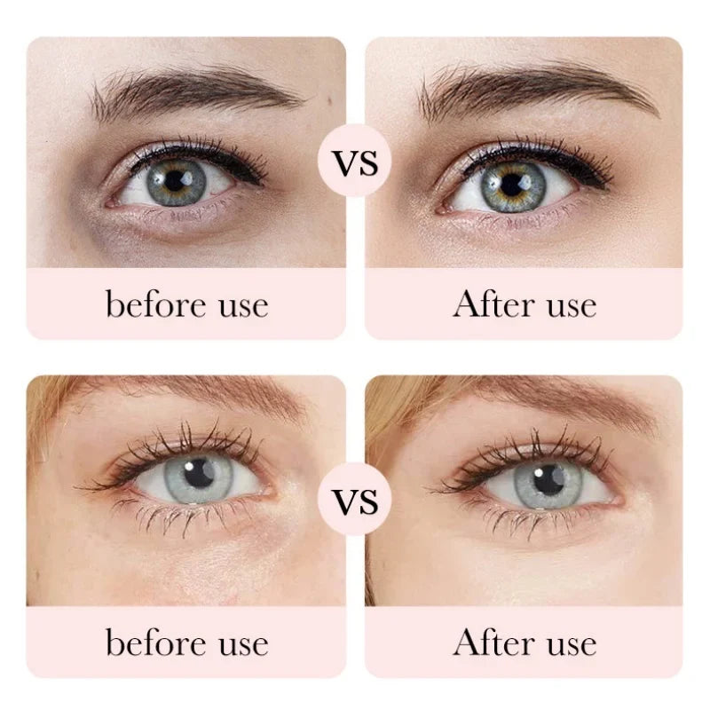 BIOAOUA Rose Hyaluronic Acid Eye Cream | Hydrating 20g