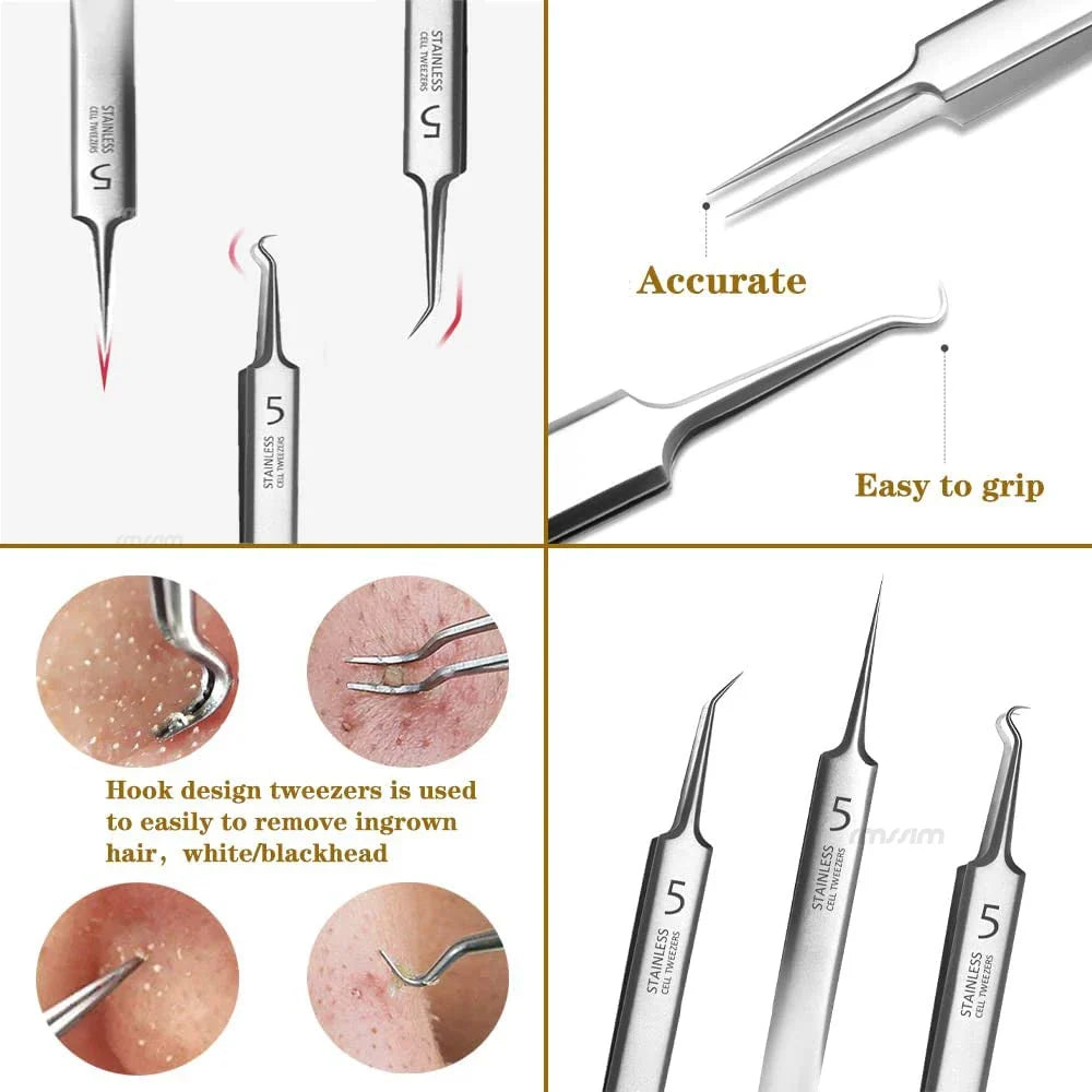Stainless Steel Blackhead Comedone Extractor Tool Set – 4 Pcs