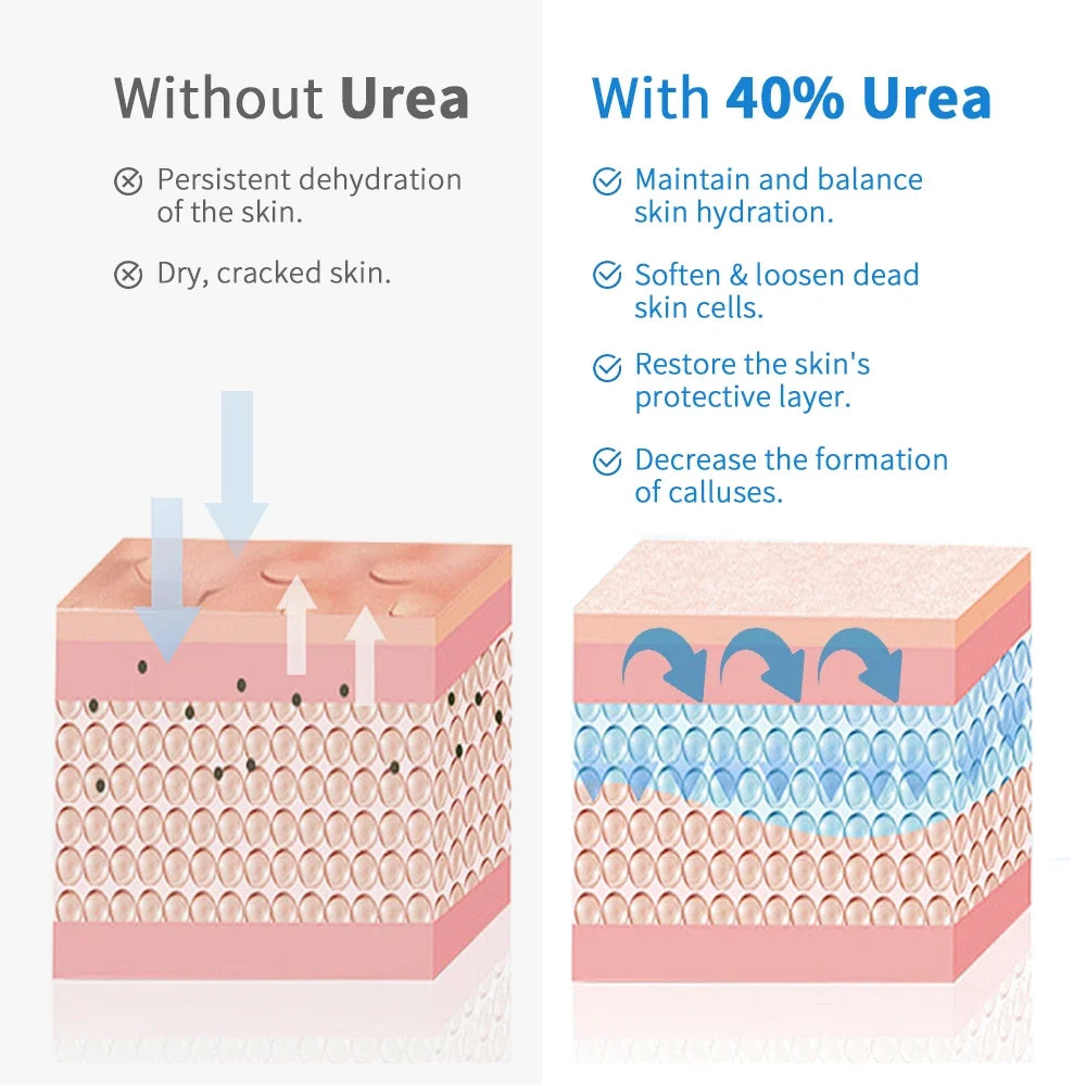 40% Urea Cream + 2% Salicylic Acid Foot & Hand Moisturizer