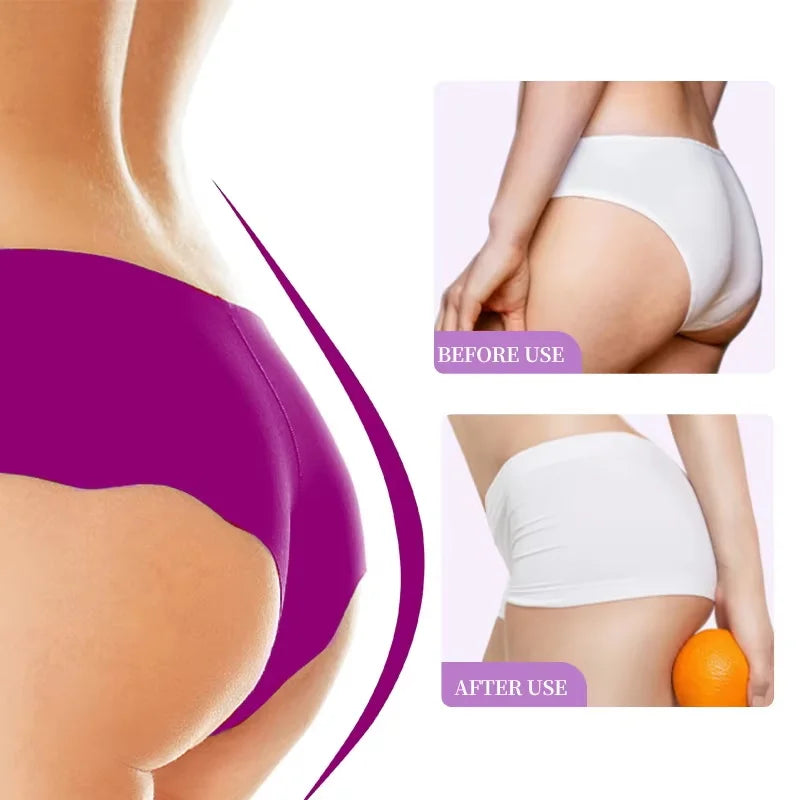 SADOER Buttock Lifting & Firming Cream – Tone & Tighten